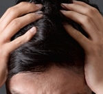 ストレス コントロールと頭皮マッサージで薄毛防止と勃起力アップ（毛髪の体験談）